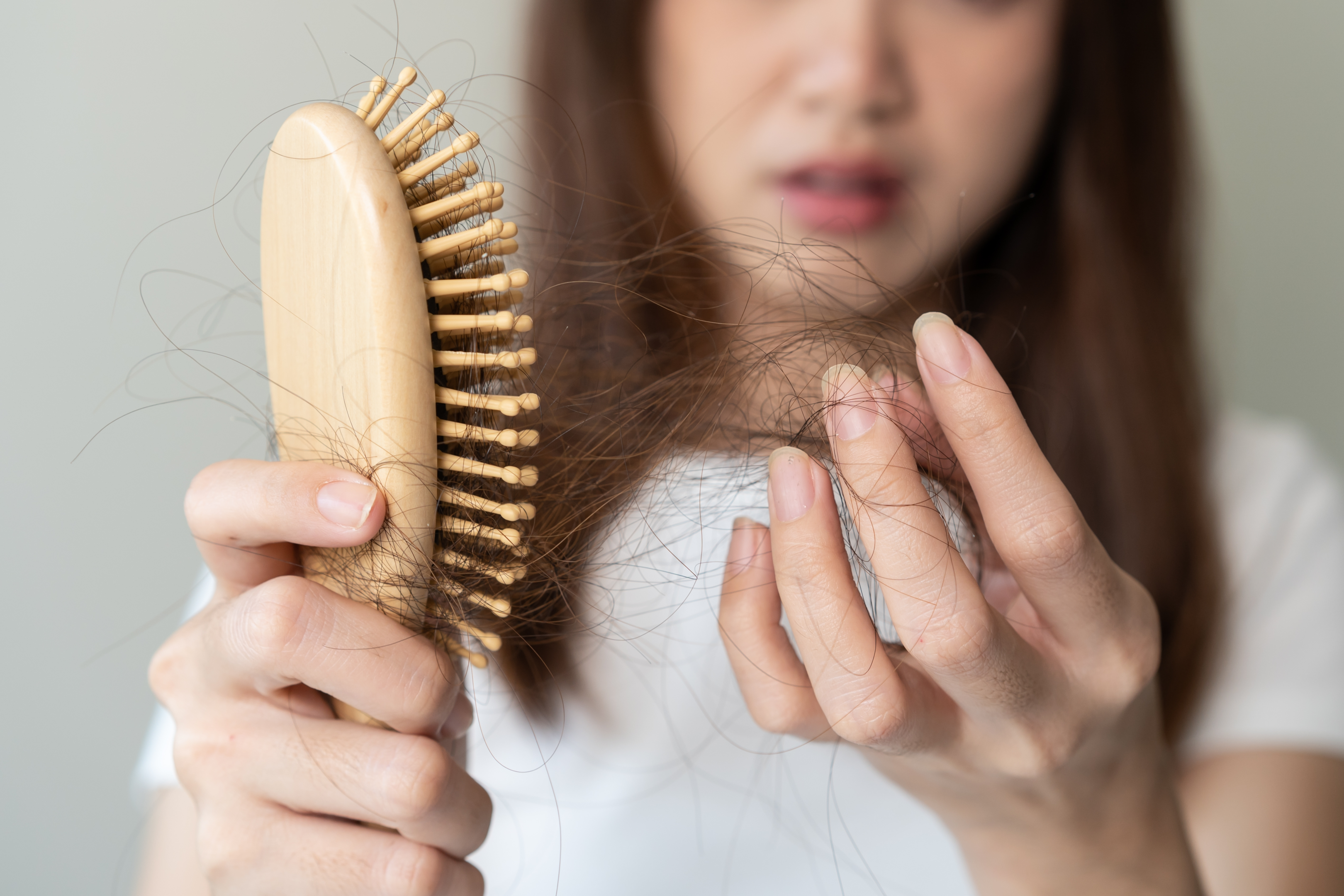 El factor hormonal es una de las causas más frecuentes de pérdida de cabello en mujeres.