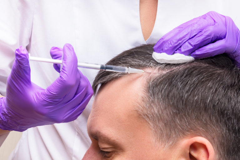 Tratamientos para mejorar la salud del cuero cabelludo