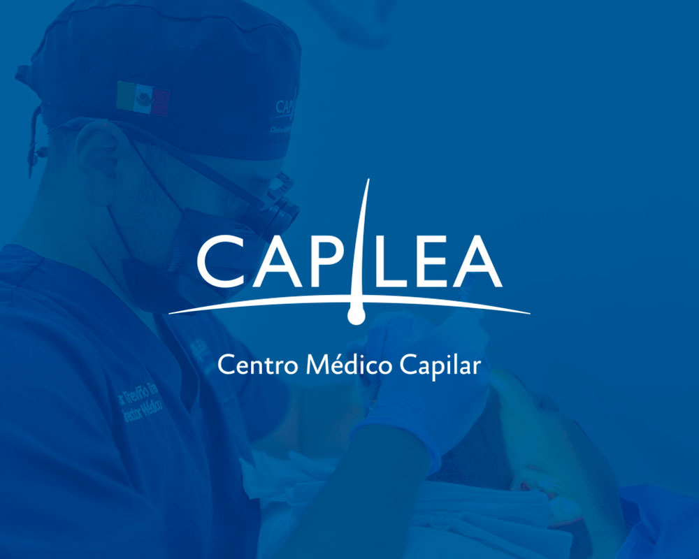 Hair Transplant Clinic Mexico hair-transplant-clinic-mexico