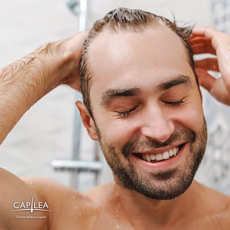 Recuerda lavar el cabello con cuidado y seguir todas las recomendaciones del especialista. 
