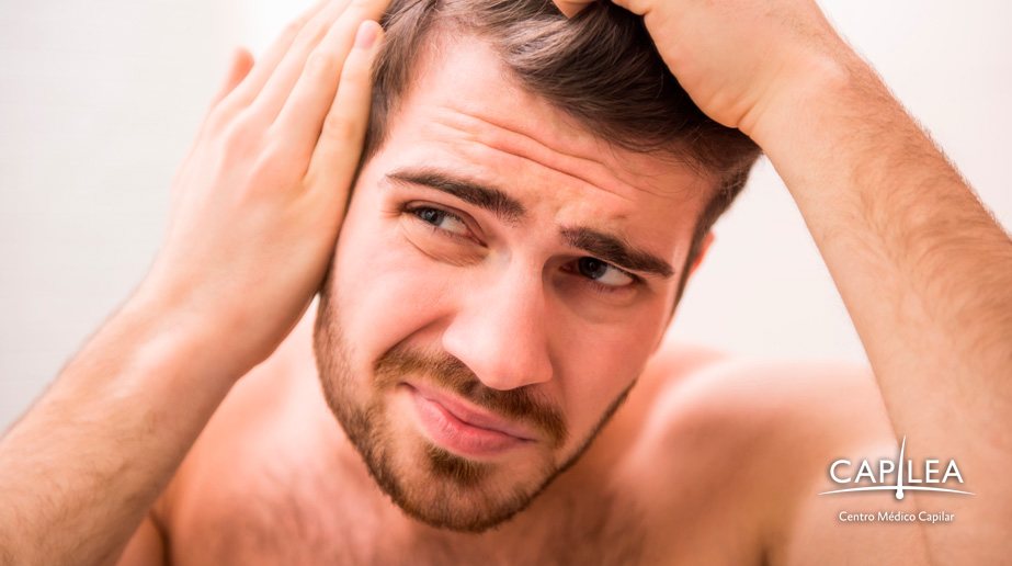 La pérdida de pelo es un situación que genera inseguridad y estrés. 