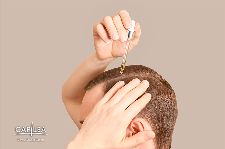 Minoxidil es usado para la pérdida de cabello. 