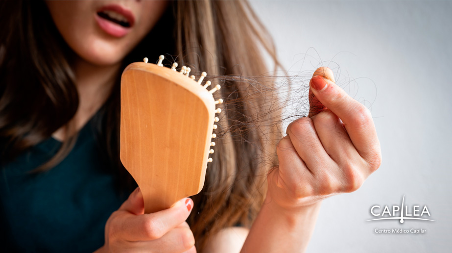 La pérdida de cabello es algo que genera estrés en la persona que la padece. 
