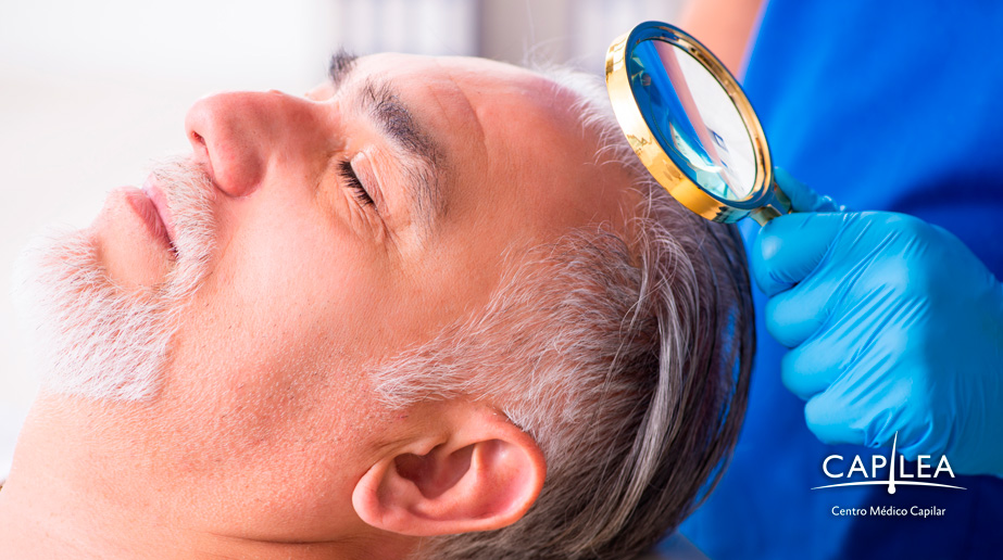 Every hair follicle is carefully placed in the area with thinning or no hair. 