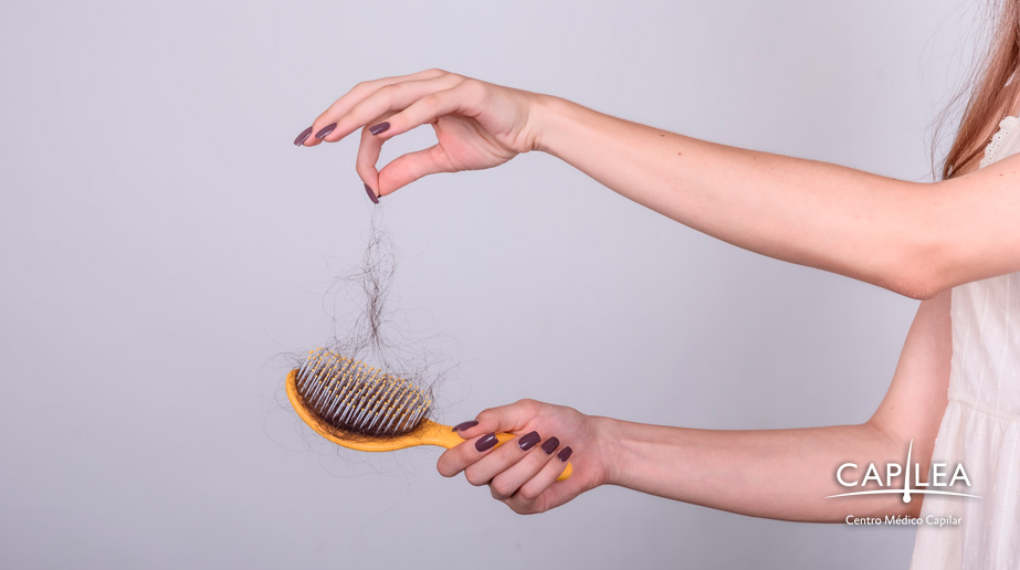 Leaving large amounts of hair in the brush is common in women with alopecia. 