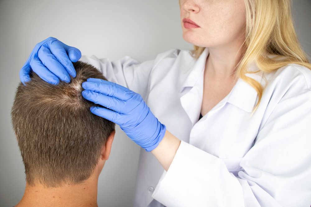 Hair transplant aftercare and recovery