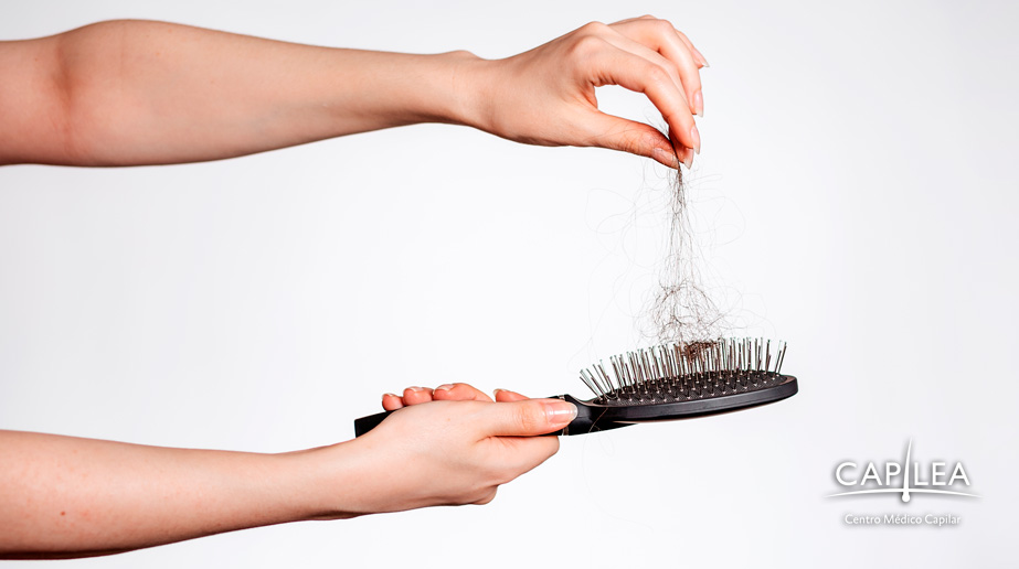 Un problema común en las personas es la caída de cabello.  