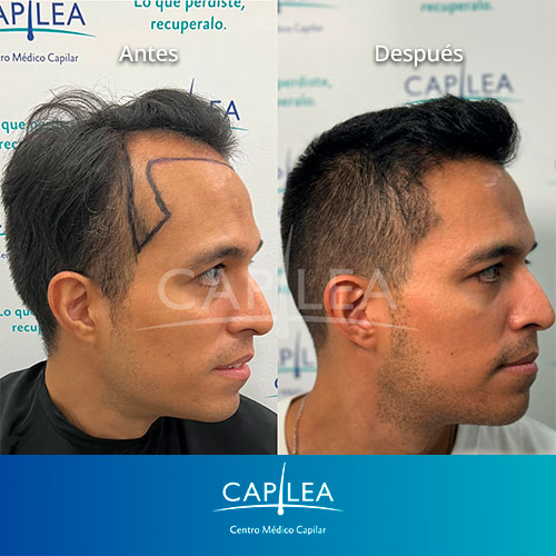 capilea-testimonios-AyD-1.jpg