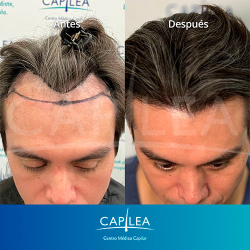 capilea-testimonios-AyD-2