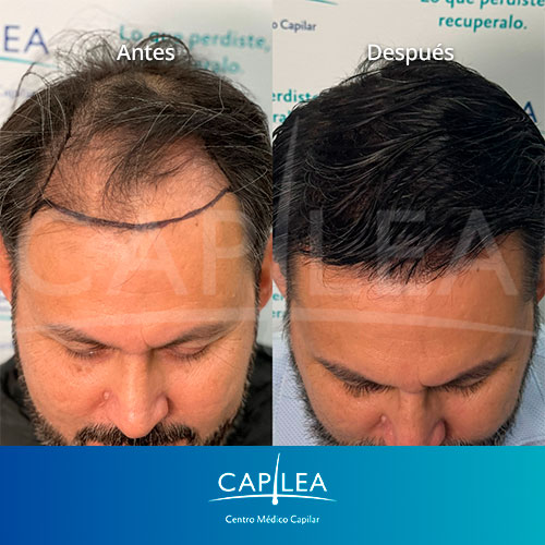 capilea-testimonios-AyD-5