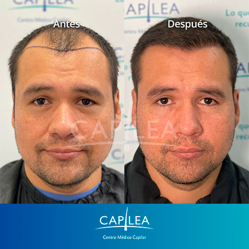 capilea-testimonios-AyD-8