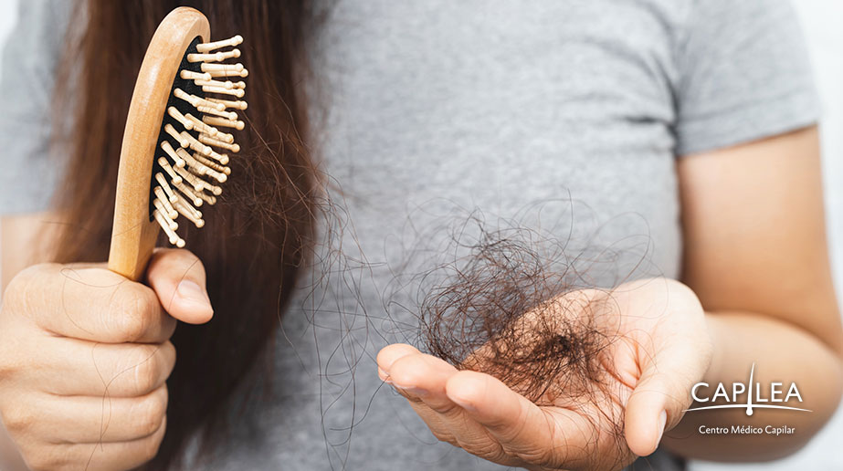 Combate la pérdida de cabello en una clínica capilar experimentada. 