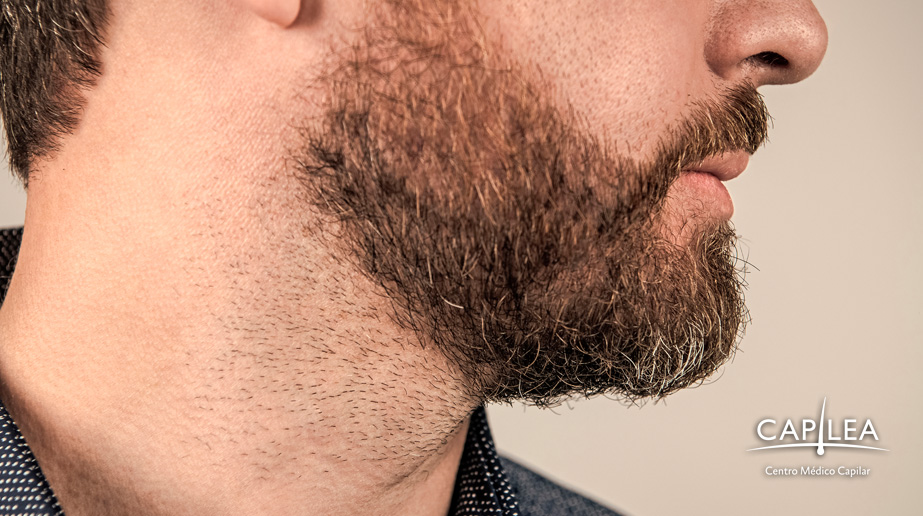 A beard graft is the ultimate solution for wearing a thick, natural beard.