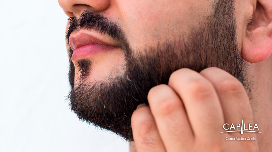 Un injerto de barba es la solución definitiva para lucir una barba densa y natural.