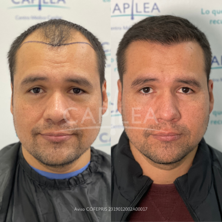 capilea-blog-mar-2-6